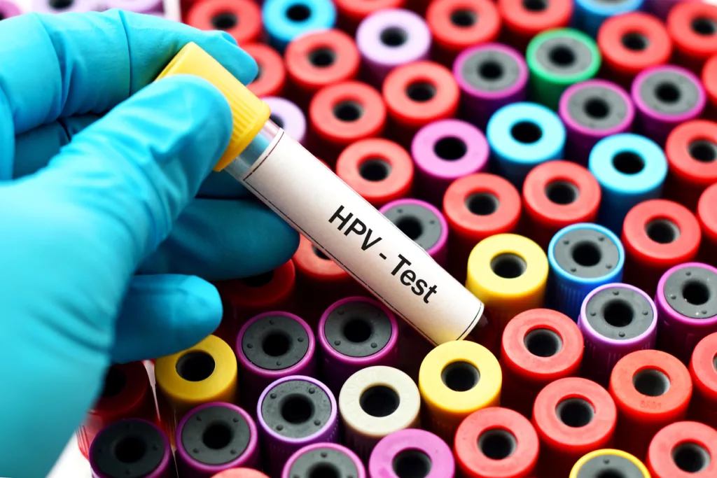 Goodbye, Pap. Hello, Swab! BC Cervix Screening transitions to HPV Self-Screening